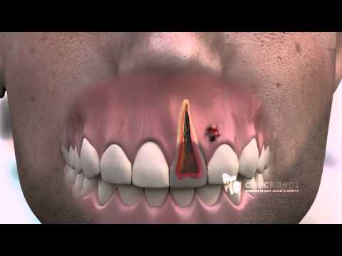 how to isolate tooth pain