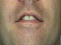 pronunciation phonics f and v