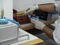 UTI-SET System - Novamed