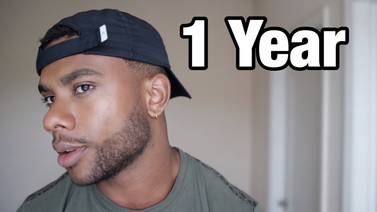 I used minoxidil for 1 year - here's what happened