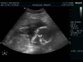 videos de First Sonogram-Christian Yishai
