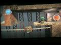 lbp,levels,love