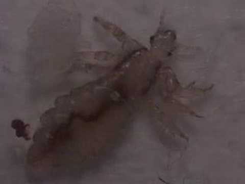 The Killer Louse