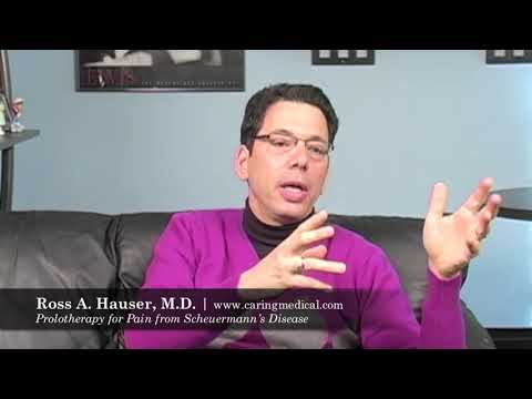 how to cure scheuermann's kyphosis