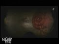 Condemned 2 - Doll Factory - Assume the Position Condemned 2 - Doll Factory - Assume the Position