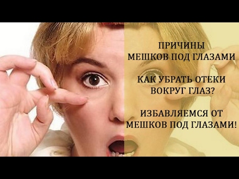 Как быстро убрать опухоль с глаз в домашних условиях Как быстро убрать опухоль с глаз в домашних условиях