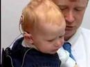 Jonah Receives Cochlear Implants
