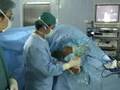 Shoulder Joint Manipulation In Anesthesia In Case Of Frozen Shoulder Shoulder Joint Manipulation In Anesthesia In Case Of Frozen Shoulder
