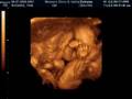 Baby Rhoads