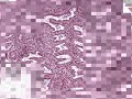 Histolog�a - Endometrio secretor