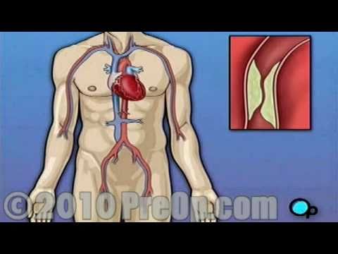 how to unclog penile arteries