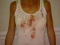 Woman Attacked By Pit Bull