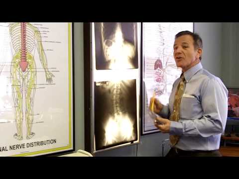 how to measure cervical curve on x-ray