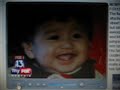 5 year old Boy Recovering After Pit Bull Attack