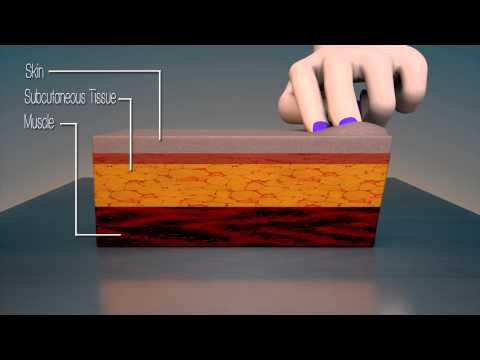 how to perform z track method