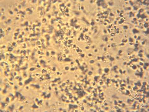 Sperm Under The Microscope