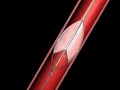 Balloon Angioplasty with Net Animation