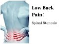 Low Back Pain: Stenosis