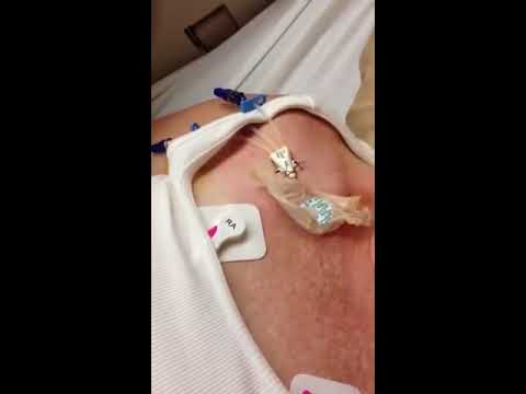 how to remove central line