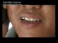 Film C-13 (1/3)