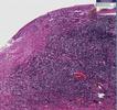 Histopathology Small intestine, ...