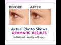 \"How to Trial HYDODERM Wrinkle Reducer for FREE\" \"How to Trial HYDODERM Wrinkle Reducer for FREE\"