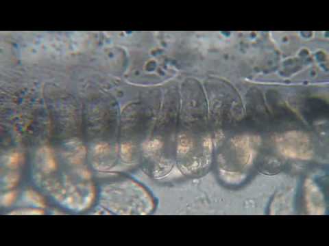 how to dissolve poop