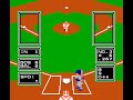 major league baseball is not a well-programmed game. an 