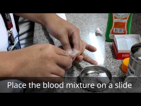 how to perform a manual rbc count