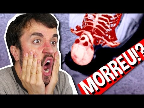 FRATURA EXPOSTA! - Skate 3 (Parte 1)
