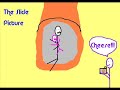 Summary of Life Story Stick Animation Part I