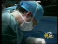 Scarless Surgery