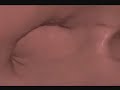 Sistema Cardiovascular