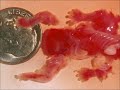 Abortion Abortion