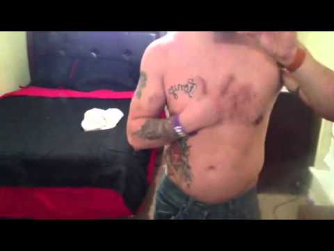 how to take winstrol