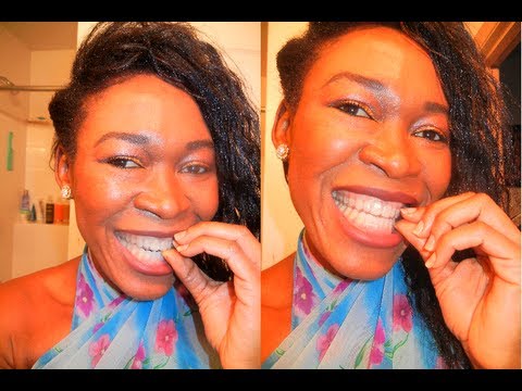 how to whiten plastic retainers