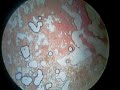 Blood Cells at 400x Magnification (Oil Immersion)