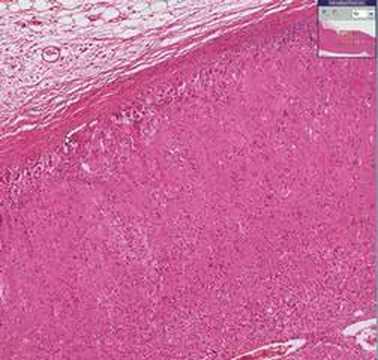Histopathology Adrenal gland ...