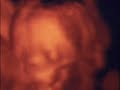 IVF Creation of Life! Birth of Logan