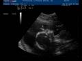 videos de BREZNAU STEPHANIE 20081120172339 1731450