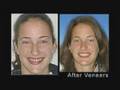 Santa Barbara Laser Dentistry - 93101