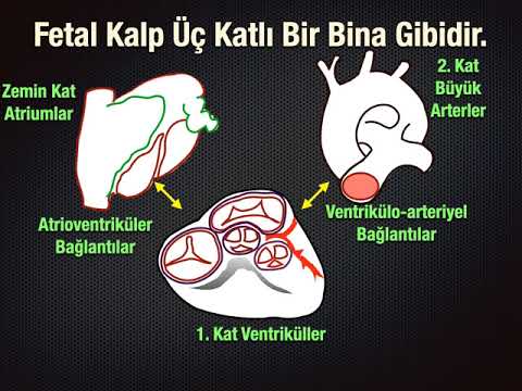 MAYIS 2021 AYI OLGUSU - Çift Girişli Sol Ventrikül ve Çift Çıkışlı Sağ Ventrikül - Dr. Namık DEMİR