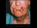 spot anti tabac