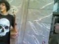 Akier con sindrome de Down Akier con sindrome de Down