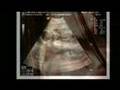 PREGNANT MOTHER FLEES UK SOCIAL SERVICES