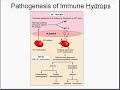 Medical School Pathology, Chapter 10g Medical School Pathology, Chapter 10g