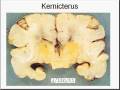 Medical School Pathology, Chapter 10g