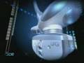Professional Endermologie : Cellu M6 Key Module