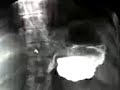 immagini digitali stomaco