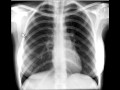 Radiology video lectures on Radiolopolis